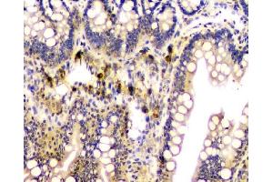IHC analysis of CA2 using anti-CA2 antibody (ABIN6719533). (CA2 antibody  (AA 2-260))
