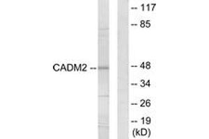 Western blot analysis of extracts from HepG2 cells, using CADM2 Antibody.