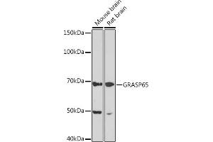 Western blot analysis of extracts of various cell lines, using GR Rabbit mAb (ABIN1679751, ABIN3015980, ABIN3015981 and ABIN7101472) at 1:1000 dilution. (GORASP1 antibody)