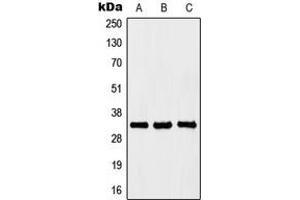 Western blot analysis of HOXB4 expression in Jurkat (A), K562 (B), PC12 (C) whole cell lysates. (HOXB4 antibody  (Center))