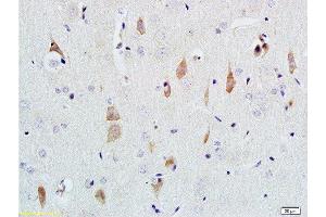 Formalin-fixed and paraffin embedded rat brain tissue labeled with Rabbit Anti-NGF-beta Polyclonal Antibody  at 1:200 followed by conjugation to the secondary antibody and DAB staining. (NGFB antibody  (AA 151-220))