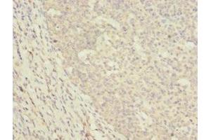 Immunohistochemistry of paraffin-embedded human tonsil tissue using ABIN7150497 at dilution of 1:100 (DNAJA2 antibody  (AA 233-412))