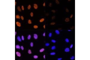 Immunofluorescence analysis of U-2 OS cells using Acetyl-Histone H3-K14 Rabbit pAb (ABIN7267666) at dilution of 100 (40x lens). (Histone 3 antibody  (H3K14))