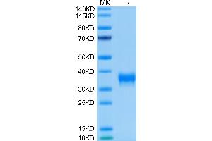Human BTN1A1 on Tris-Bis PAGE under reduced condition. (BTN1A1 Protein (AA 27-242) (His-Avi Tag))