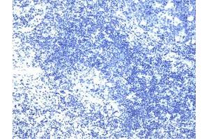 Cells treated with a phosphatase to eliminate all phosphorylation (LAT antibody  (pTyr226))