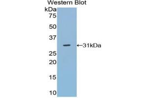 Western blot analysis of the recombinant protein. (TRADD antibody  (AA 21-259))