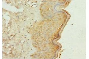 Immunohistochemistry of paraffin-embedded human skin tissue using ABIN7163882 at dilution of 1:100