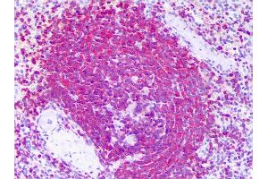 Anti-RICTOR antibody IHC of human spleen. (RICTOR antibody  (AA 1-99))