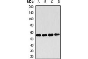 Western blot analysis of FKBP4 expression in Hela (A), Jurkat (B), MCF7 (C), mouse testis (D) whole cell lysates. (FKBP4 antibody)