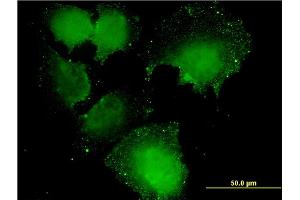 Immunofluorescence of monoclonal antibody to CNOT7 on HeLa cell. (CNOT7 antibody  (AA 1-285))
