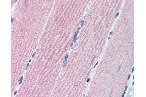 Anti-PRKG1 / CGKI antibody IHC of human skeletal muscle. (PRKG1 antibody  (AA 657-671))