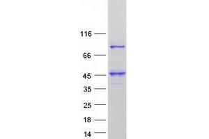 Western Blotting (WB) image for UBX Domain Protein 11 (UBXN11) (Transcript Variant 3) protein (Myc-DYKDDDDK Tag) (ABIN2734930)