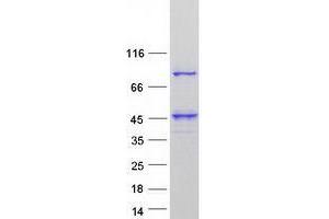 Validation with Western Blot (UBXN11 Protein (Transcript Variant 3) (Myc-DYKDDDDK Tag))