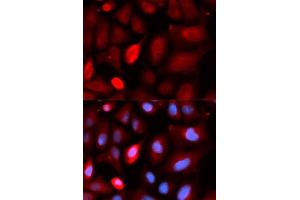 Immunofluorescence analysis of U2OS cells using PDLIM5 antibody. (PDLIM5 antibody  (AA 317-596))