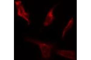 ABIN6267064 staining HepG2 by IF/ICC. (AKT 1/2/3 antibody  (pTyr312, pTyr315, pTyr316))