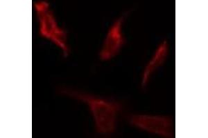 ABIN6267064 staining HepG2 by IF/ICC. (AKT 1/2/3 antibody  (pTyr312, pTyr315, pTyr316))