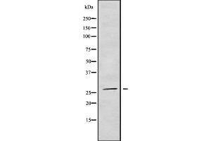 Western blot analysis NRIP3 using COLO205 whole cell lysates