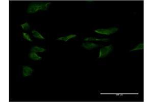 Immunofluorescence of monoclonal antibody to SP1 on HeLa cell. (SP1 antibody  (AA 522-618))