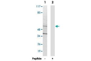 Western blot analysis of extracts from 293 cells, using CYP21A2 polyclonal antibody .