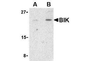 Western blot analysis of BIK in Jurkat cell lysate with AP30150PU-N BIK antibody at (A) 1 and (B) 2 μg/ml. (BIK antibody  (N-Term))