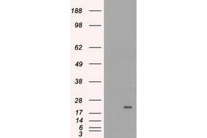 HEK293T cells were transfected with the pCMV6-ENTRY control (Left lane) or pCMV6-ENTRY CRYAB (Right lane) cDNA for 48 hrs and lysed. (CRYAB antibody)