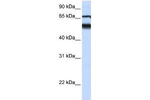 WB Suggested Anti-DKFZP564J0863 Antibody Titration:  0.