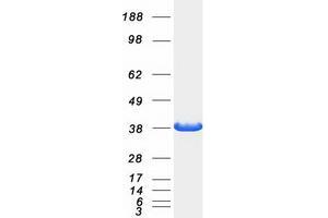 Validation with Western Blot (SORD Protein (Myc-DYKDDDDK Tag))