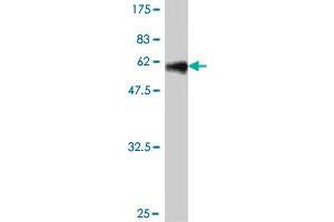 Western Blot detection against Immunogen (57. (DLX3 antibody  (AA 1-287))