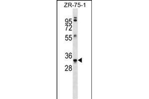 MBP Antibody (Ascites) ABIN1539854 western blot analysis in ZR-75-1 cell line lysates (35 μg/lane). (MBP antibody)