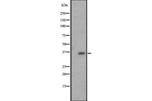 Western blot analysis of OR2M4 expression in Jurkat whole cell lysate ,The lane on the left is treated with the antigen-specific peptide. (OR2M4 antibody)