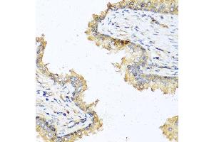 Immunohistochemistry of paraffin-embedded human prostate using DEFB121 antibody at dilution of 1:100 (40x lens). (DEFB121 antibody)