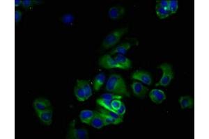 Immunofluorescence staining of MCF-7 cells with ABIN7174125 at 1:133, counter-stained with DAPI. (SIRPA antibody  (AA 31-373))