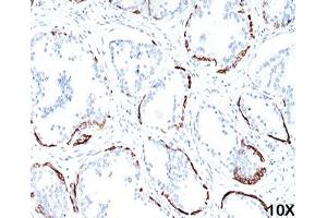 IHC staining of human prostate (10X) with HMW Cytokeratin antibody (34bE12). (KRT1 antibody)