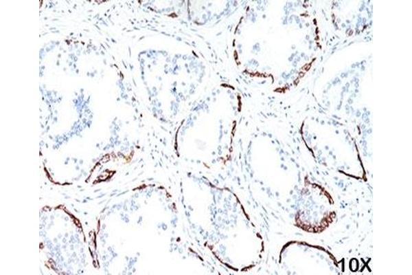 KRT1 antibody