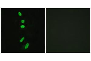 Immunofluorescence analysis of HeLa cells, using SF1 (epitope around residue 82) antibody. (Splicing Factor 1 antibody  (Ser82))