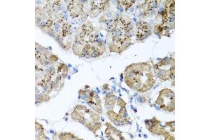Immunohistochemistry of paraffin-embedded human stomach using PPOX antibody (ABIN5973799) at dilution of 1/100 (40x lens).