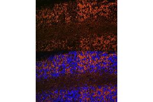 Immunofluorescence analysis of rat brain using Aquaporin-4 (Aquaporin-4 ) Rabbit mAb (ABIN7265653) at dilution of 1:100 (40x lens). (Aquaporin 4 antibody)