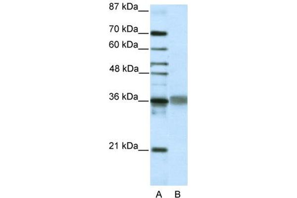 TLX2 antibody  (C-Term)