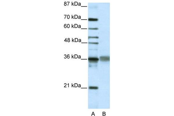 TLX2 anticorps  (C-Term)