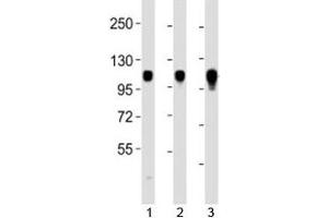 Western blot testing of Integrin alpha 7 antibody at 1:2000 dilution.