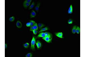 SLC12A9 antibody  (AA 126-173)