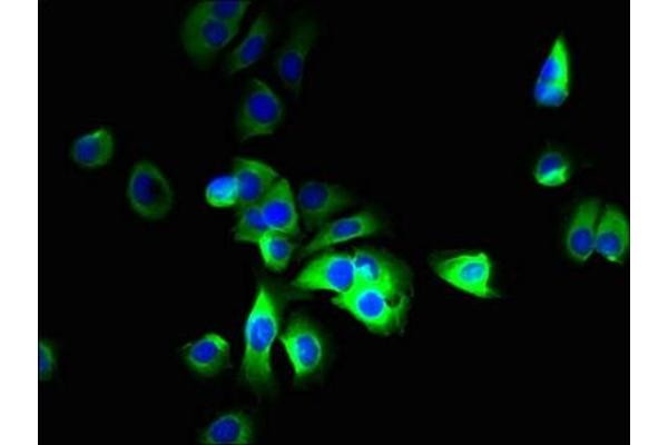 SLC12A9 antibody  (AA 126-173)