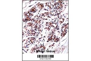 UBP1 Antibody immunohistochemistry analysis in formalin fixed and paraffin embedded human breast tissue followed by peroxidase conjugation of the secondary antibody and DAB staining. (UBP1 antibody  (AA 266-295))