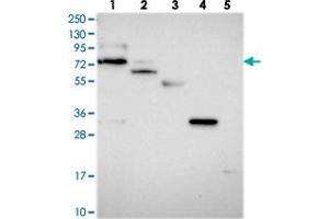 Western blot analysis of Lane 1: RT-4, Lane 2: U-251 MG, Lane 3: Human Plasma, Lane 4: Liver, Lane 5: Tonsil with ARHGAP44 polyclonal antibody . (ARHGAP44 antibody)