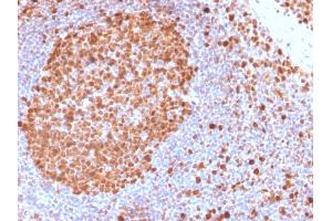 Immunohistochemistry (IHC) image for anti-Minichromosome Maintenance Complex Component 7 (MCM7) (AA 195-319) antibody (ABIN6940025)