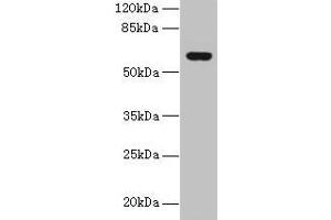 Western blot All lanes: KATNAL2 antibody at 1 μg/mL + U251 whole cell lysate Secondary Goat polyclonal to rabbit IgG at 1/10000 dilution Predicted band size: 62, 53 kDa Observed band size: 62 kDa (KATNAL2 antibody  (AA 18-307))
