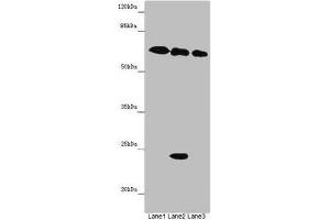Western blot All lanes: TOX3 antibody at 9 μg/mL Lane 1: Mouse heart tissue Lane 2: Mouse spleen tissue Lane 3: Mouse brain tissue Secondary Goat polyclonal to rabbit IgG at 1/10000 dilution Predicted band size: 63 kDa Observed band size: 63, 24 kDa