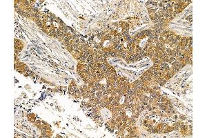 ABIN7096016 and ABIN7100078 at 1/100 staining rat pancreatic tissue by IHC-P. (STXBP5 antibody)