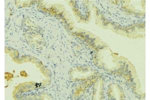 ABIN6273068 at 1/100 staining Mouse colon tissue by IHC-P.