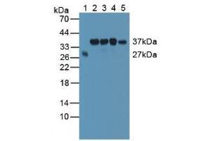 Figure. (SMN2 antibody  (AA 16-251))